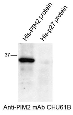 Western blotting of antibody CHU61B and PIM2-His recombinant protein recombinant protein